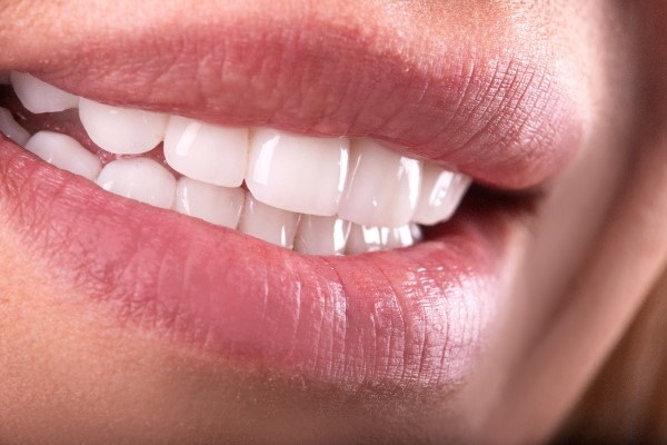 You Can Brighten Your Smile With Dental Bonding