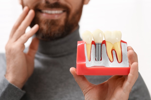Dental Implant Restoration For A Missing Tooth
