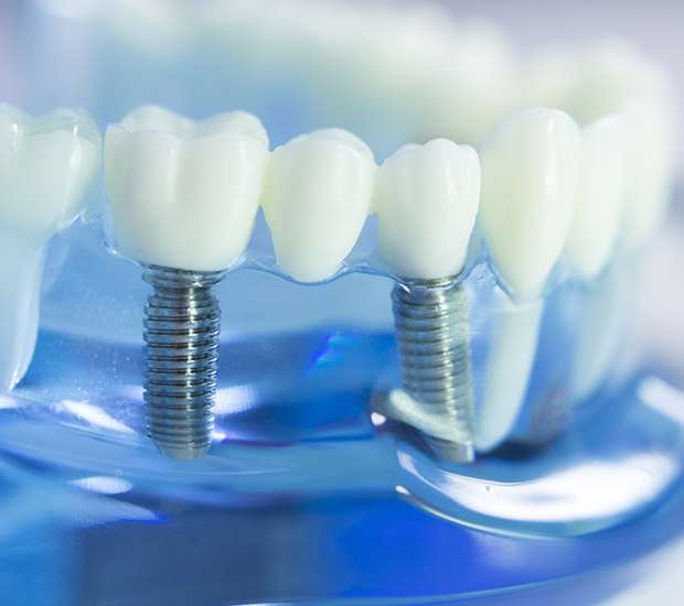Albuquerque Dental Prosthetics