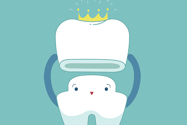 How Common Is Dental Crown Replacement? from Family Choice Dental in Albuquerque, NM