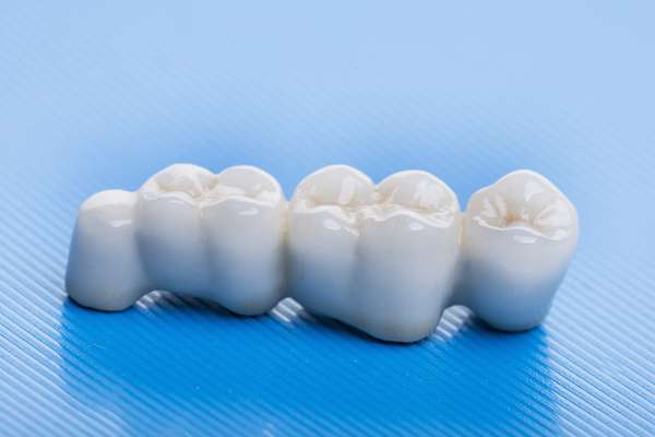 How Many Teeth Can Dental Bridges Replace from Family Choice Dental in Albuquerque, NM