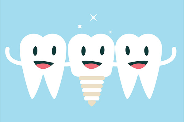 Implant Dentistry Aftercare FAQs from Family Choice Dental in Albuquerque, NM