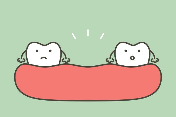 Why Missing Teeth Need To Be Replaced