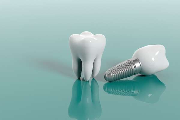 questions-to-ask-your-implant-dentist