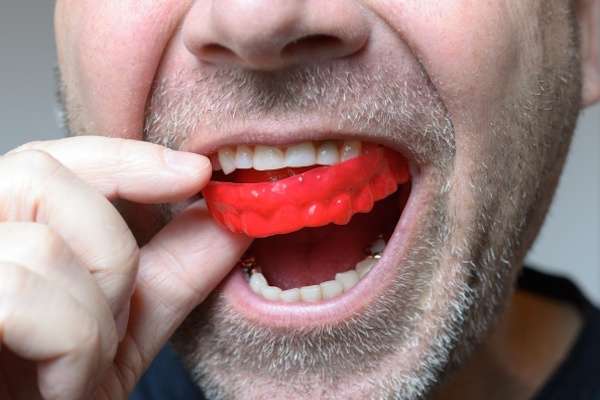 Save Your Teeth by Wearing Mouth Guards at Night from Family Choice Dental in Albuquerque, NM