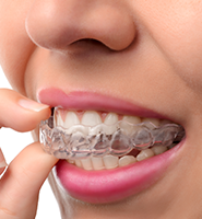 Clear Aligners - Almost Invisible Braces Albuquerque, NM