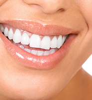 Teeth Whitening Services Albuquerque, NM