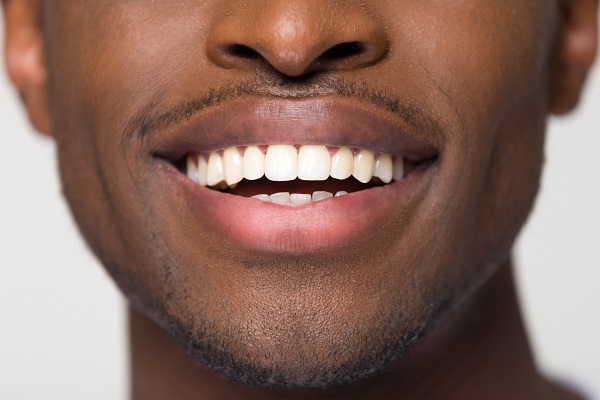 Ask A Dentist: How Do I Choose The Best Teeth Straightening Option For Me?