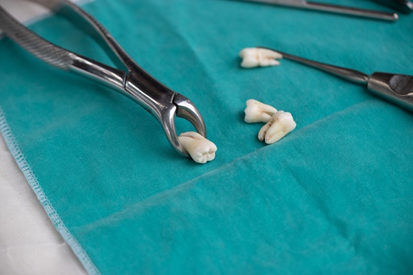 Tooth Extraction For An Impacted Tooth