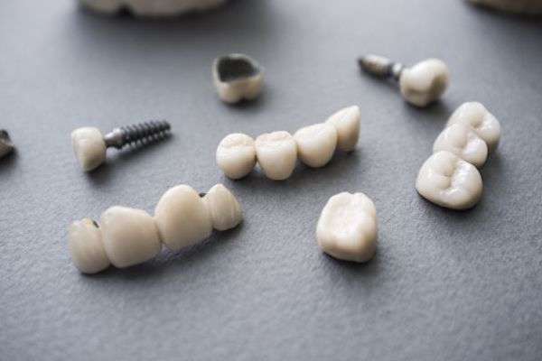 Types of Dental Implants from Family Choice Dental in Albuquerque, NM