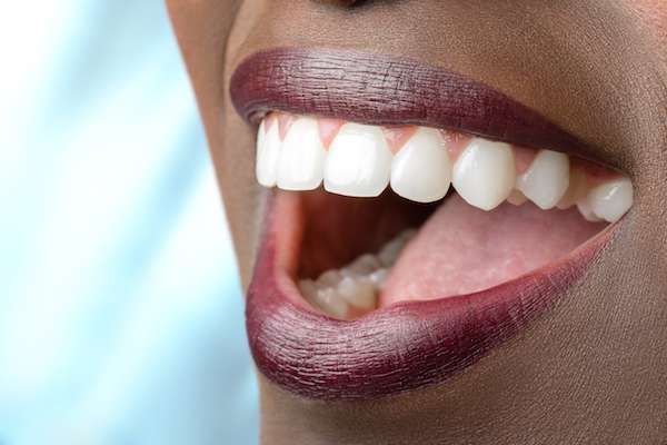 Routine Dental Care: What Are Tooth Colored Fillings from Family Choice Dental in Albuquerque, NM